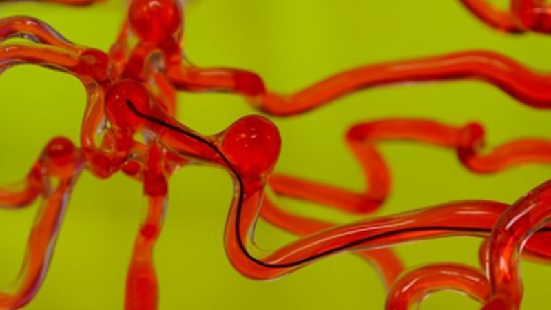 麻省理工開發(fā)磁控線性機器人，能在腦血管中自由穿梭